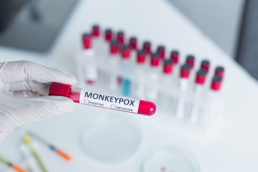 Testing for Mpox, Monkeypox virus